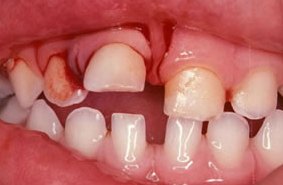 Urgencias Dentales